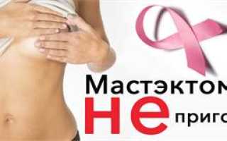 Реконструкция молочной железы после мастэктомии: важные аспекты и советы